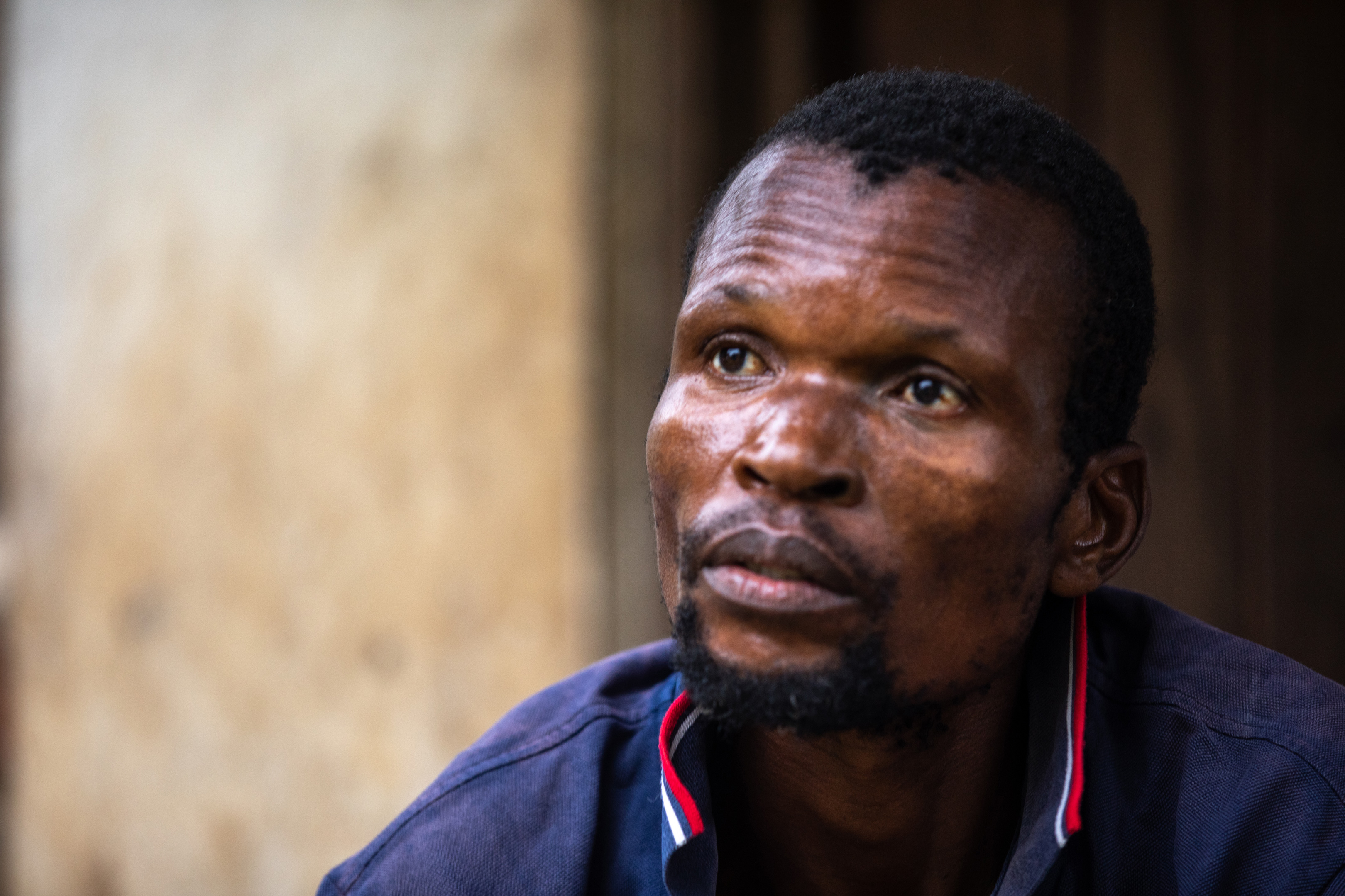  TB patient James Willo in Neno, Malawi