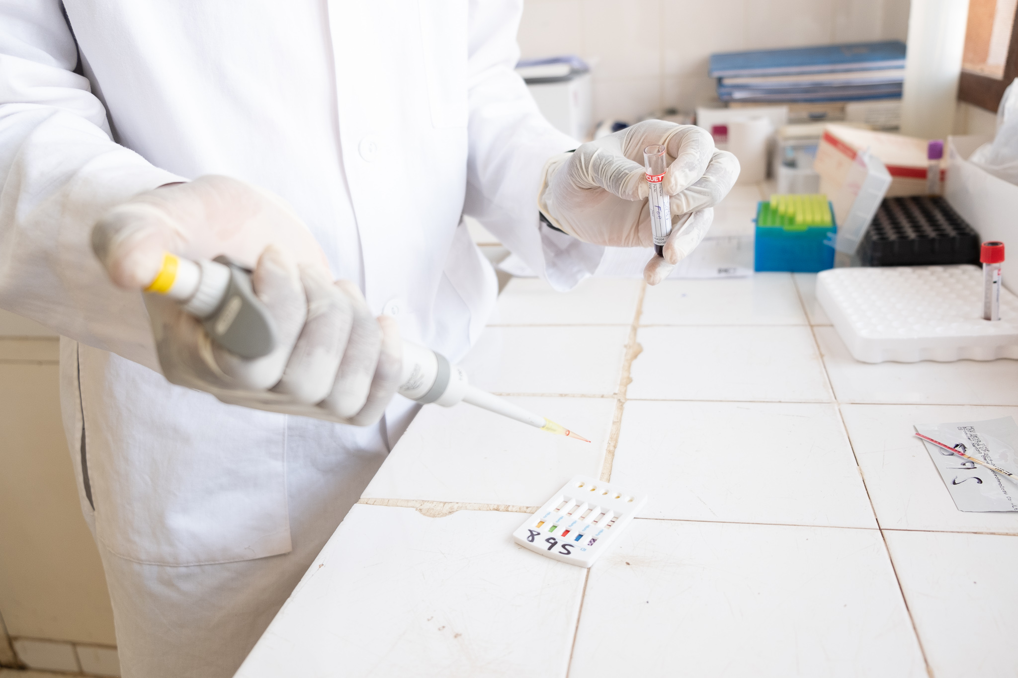 blood test for hepatitis B in Sierra Leone