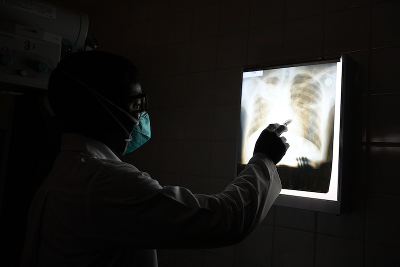Dr. Lawrence Oyewusi at Botsabelo MDR-TB Hospital in Maseru, Lesotho in August 2022.