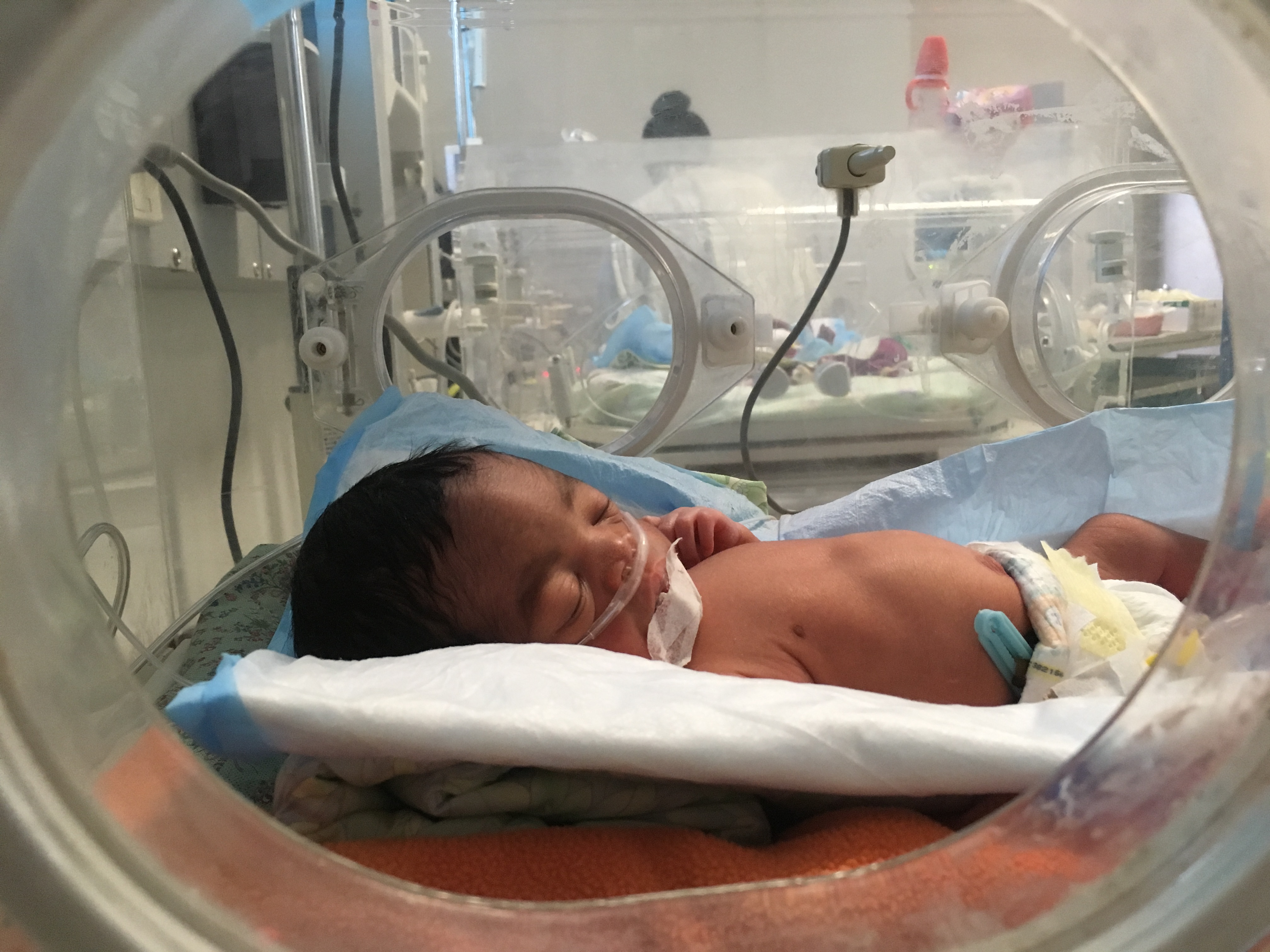 one of quadruplets born at University Hospital in Haiti