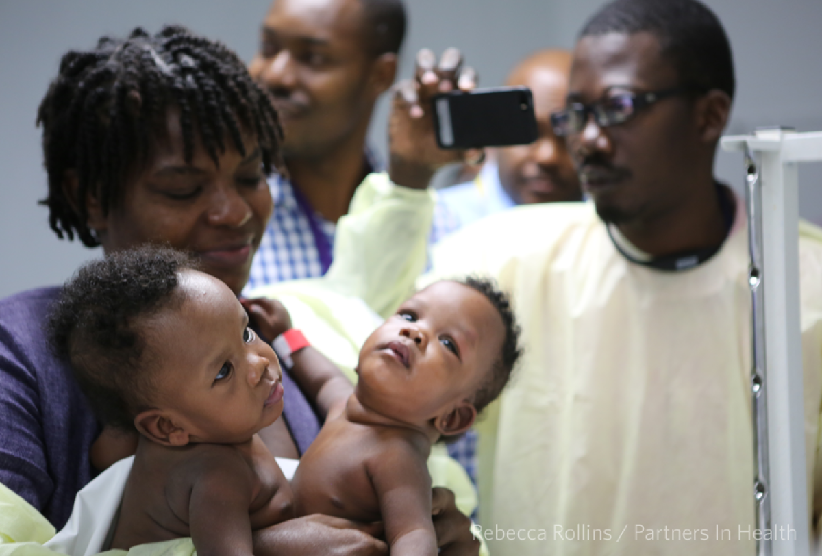 Conjoined Twins Separated in Haiti