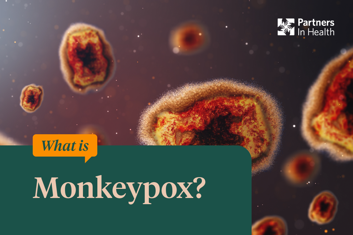 7 Things To Know About Monkeypox