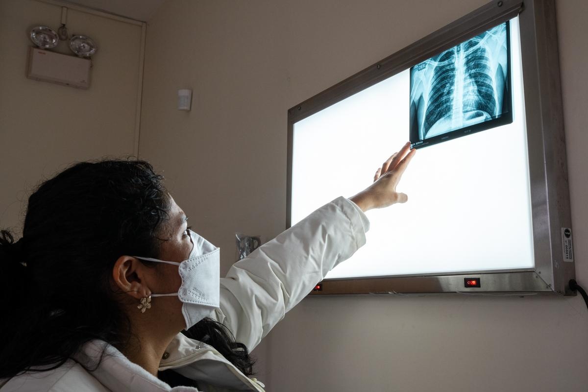 A clinician reviews the chest X-ray of a patient participating in the endTB clinical trial in Peru.