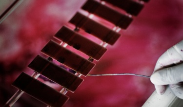 World TB Day: A Q&A With Expert Carole Mitnick