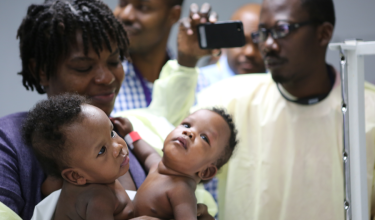 Conjoined Twin Sisters Successfully Separated in Haiti
