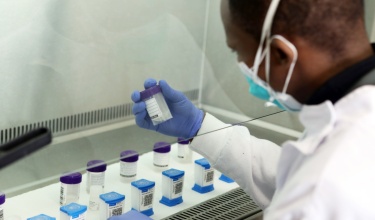 A person in a lab coat holds a sample container under a hood in a laboratory with GeneXpert cartridges