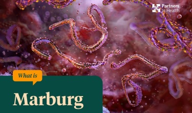 Marburg virus under microscope